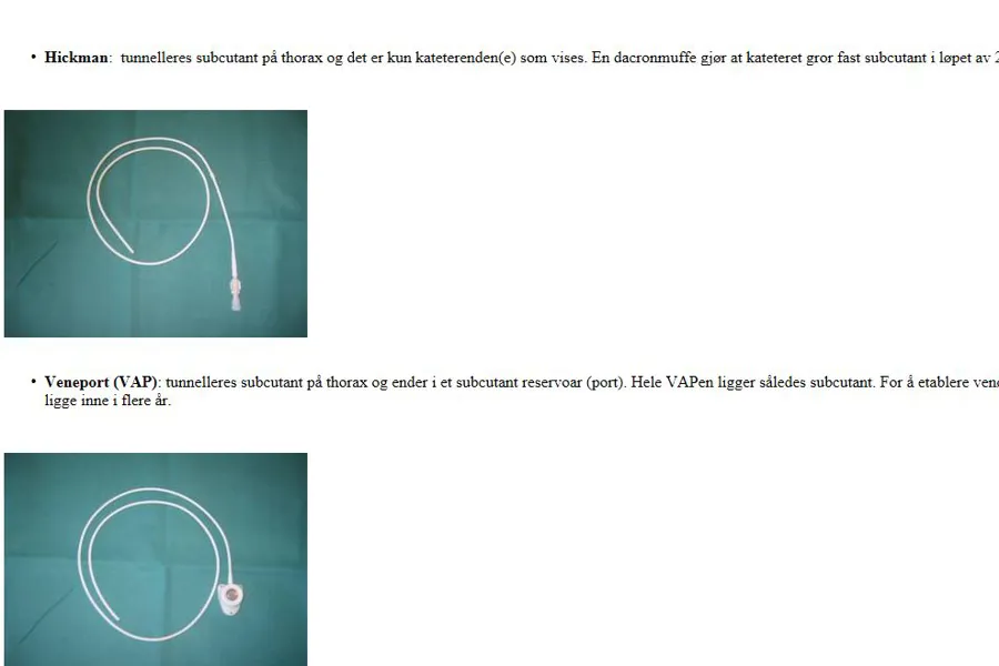 Skjermbilde fra prosedyren i EQS