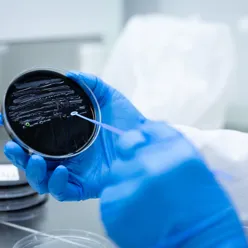 legionella agar skål