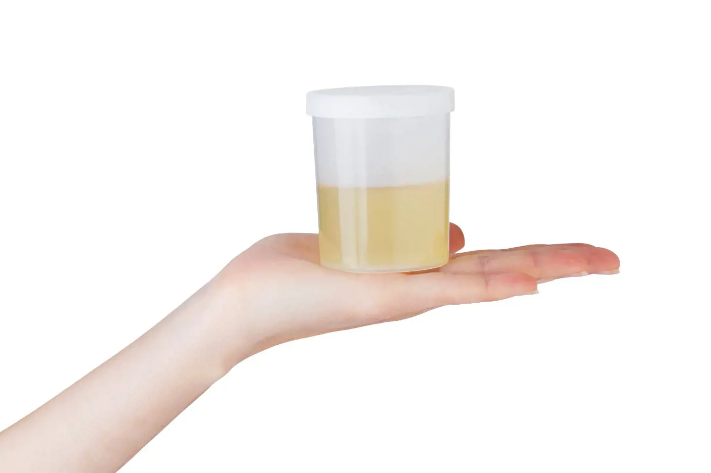 En person holder en urinprøve i hånden