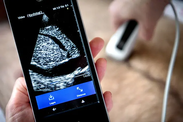 En liten håndholdt skjerm viser et ultralydbilde av en persons hjerte.